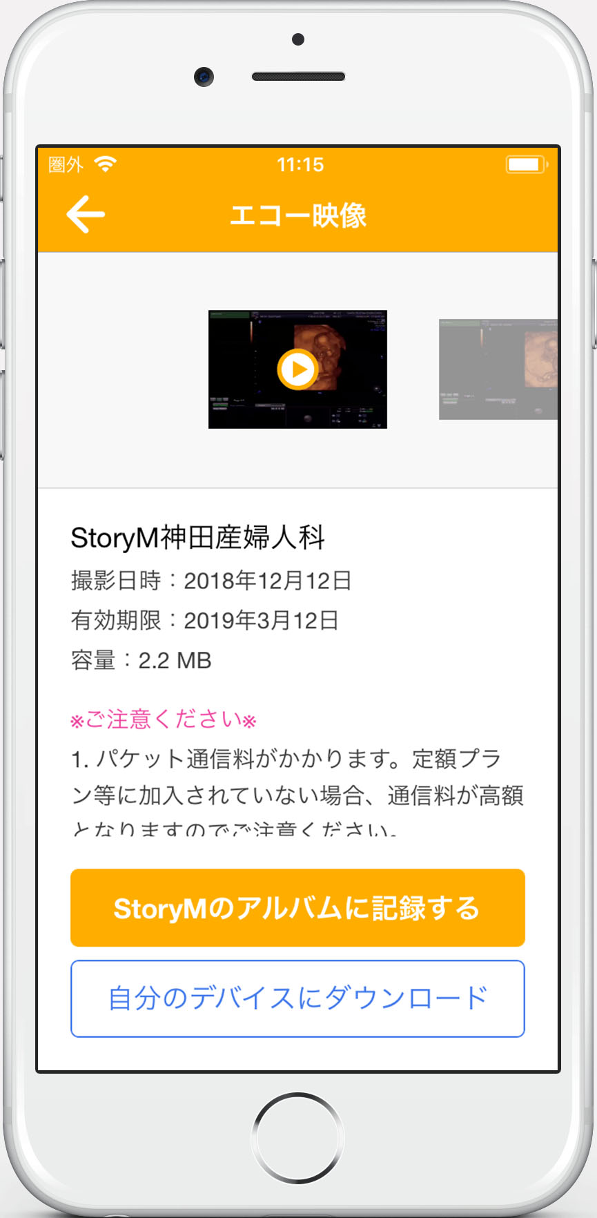 産婦人科にてエコー検査したあかちゃんの動画 画像を確認 ダウンロードする